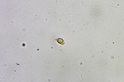 hygrophorus-hypothejus7