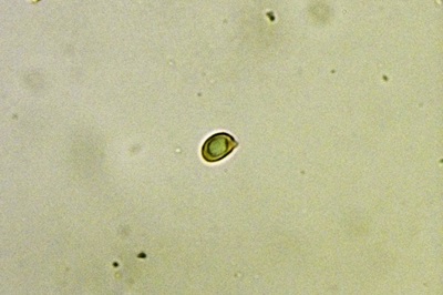 hygrophorus-lindtneri10