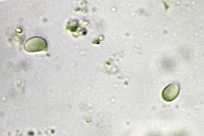 hygrophorus-nemoreus12