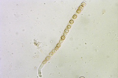 hypocrea-gelatinosa10