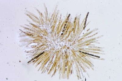 hypocrea-gelatinosa11