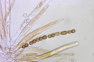hypocrea-gelatinosa9