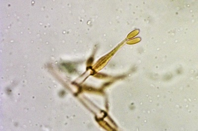 hypomyces-hyalinus10