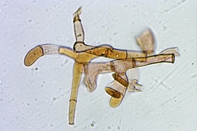 hypomyces-hyalinus12