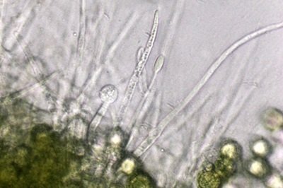 hypomyces-microspermus