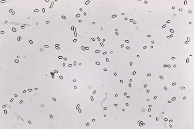 hypomyces-microspermus