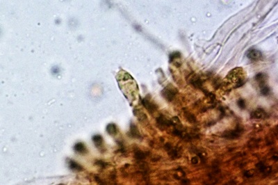 hypsizygus-tessulatus10