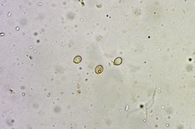 hypsizygus-tessulatus8