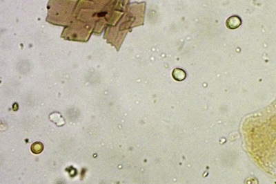 hypsizygus-tessulatus9