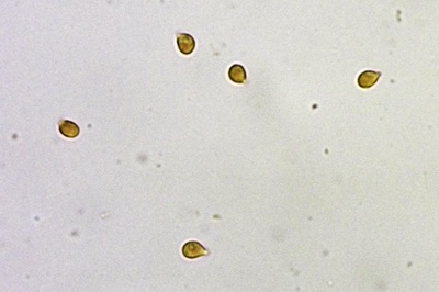 infundibulicybe-gibba4