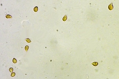 infundibulicybe-gibba5