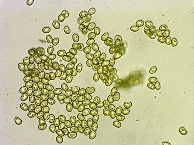 inonotus-cuticularis7