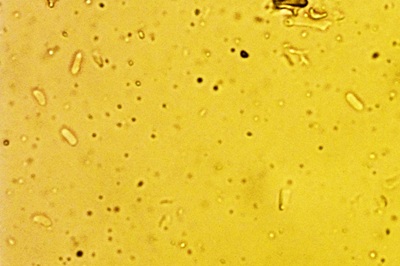 irpex-lacteus4