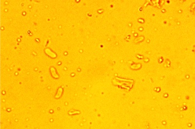 irpex-lacteus5