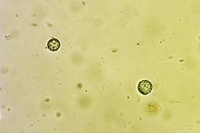 laccaria-amethystina11