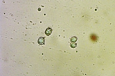 lactarius-deliciosus11