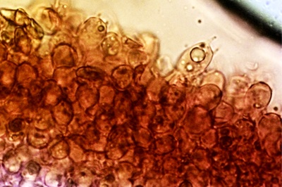 lepiota-oreadiformis10