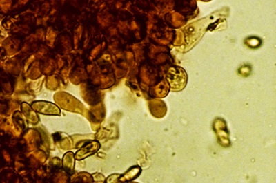 lepiota-oreadiformis11