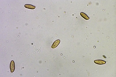 lepiota-oreadiformis8