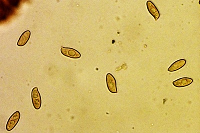 lepiota-oreadiformis9