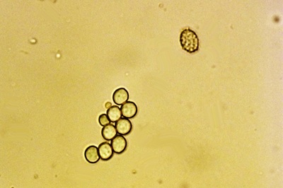 leucopaxillus-gentianeus12
