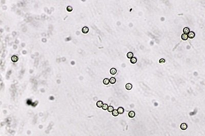 lycoperdon-perlatum