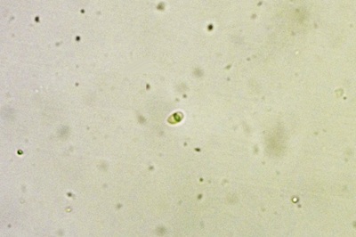 metuloidea-fragrans9