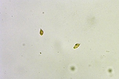 mycena-epipterygia10