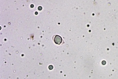 mycena-inclinata11