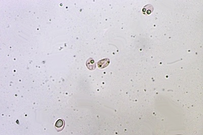 mycena-inclinata12