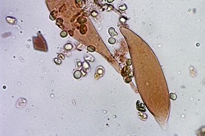 mycena-niveipes9
