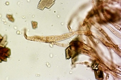 mycena-tintinnabulum12