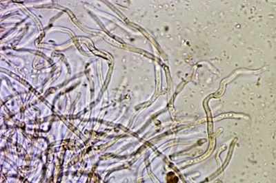 mycogloea-macrospora10