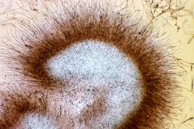 mycogloea-macrospora11