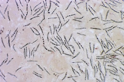 mycogloea-macrospora12