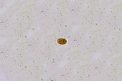 mycogloea-macrospora6