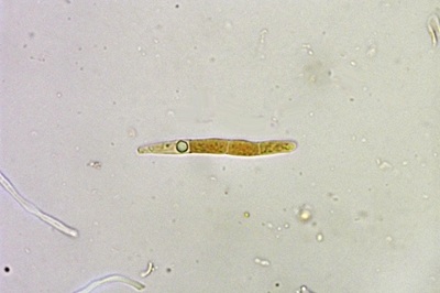 mycogloea-macrospora7