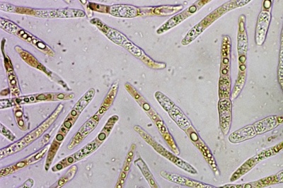mycogloea-macrospora8