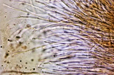 mycogloea-macrospora9