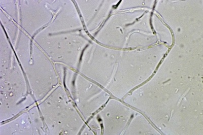 myxarium-nucleatum11