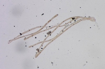 paragalactinia-succosa11