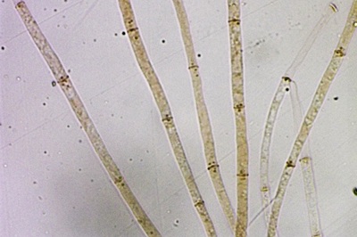 paragalactinia-succosa12