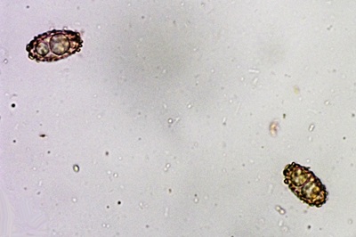 paragalactinia-succosa8