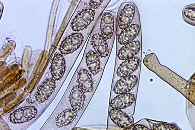 paragalactinia-succosa9