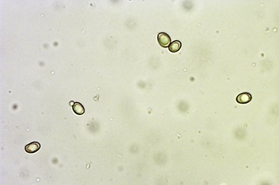 paxillus-rubicundulus12