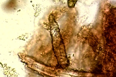 peniophora-incarnata11