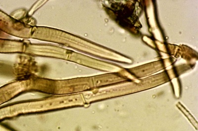 phaeomarasmius-erinaceus11