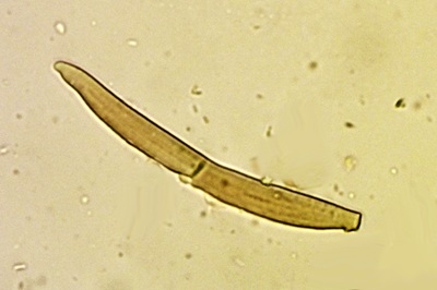 phaeomarasmius-erinaceus9