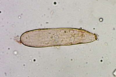phylloporus-pelletieri11