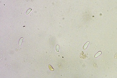 pleurotus-cornucopiae9